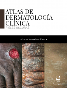 Caratula libro Atlas de dermatología clínica. Pieles oscuras