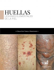 Caratula libro Huellas. Lesiones elementales de la piel